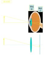 Hiệu ứng bài Mắt (Lý 9)