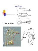 Bài giảng THÔNG TiỂU DẪN LƯU NƯỚC TiỂU RỬA BÀNG QUANG part 4 docx