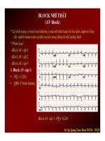 Điện tâm đồ, block nhĩ thất