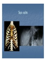 Bài giảng sỏi hệ tiết niệu part 3 pptx