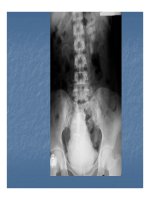Bài giảng bệnh lý hay gặp của bàng quang part 3 pptx
