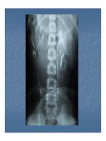 Bài giảng một số bất thường bẩm sinh bộ máy tiết niệu part 6 ppsx