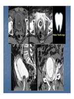 Bài giảng bệnh lý hay gặp của bàng quang part 6 pptx