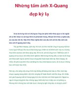 Những tấm ảnh X-Quang đẹp kỳ lạ potx