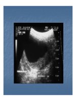 Bài giảng bệnh lý hay gặp của bàng quang part 7 doc