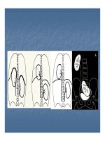 Bài giảng một số bất thường bẩm sinh bộ máy tiết niệu part 2 pptx