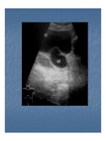 Bài giảng sa lồi niệu quản - bàng quang part 2 pot