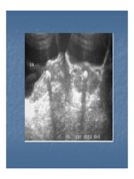 Bài giảng sỏi hệ tiết niệu part 8 ppsx