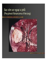 Giải phẫu bệnh - U biểu mô, U liên kết part 9 pps