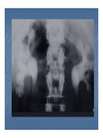 Bài giảng triệu chứng học hình ảnh hệ tiết niệu part 4 ppt