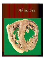 Giải phẫu bệnh - Tắc mạch ( Embolie) part 4 pot