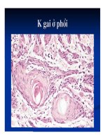 Giải phẫu bênh - Ung thư phổi và ung thư thận part 2 pot