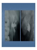 Bài giảng kỹ thuật thăm khám và hình ảnh của hệ tiết niệu part 5 pdf