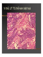 Giải phẫu bệnh - Bệnh tuyến giáp part 8 doc