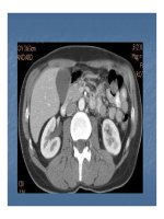 Bài giảng kỹ thuật thăm khám và hình ảnh của hệ tiết niệu part 10 docx
