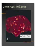 Giải phẫu bệnh - Ung thư part 8 ppsx