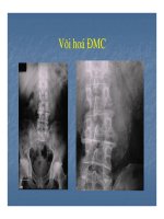 Bài giảng sỏi hệ tiết niệu part 5 doc