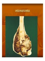 Giải phẫu bệnh - Bệnh học u part 6 pps