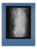 Bài giảng bệnh lý hay gặp của bàng quang part 2 pot