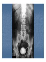 Bài giảng triệu chứng học hình ảnh hệ tiết niệu part 6 pptx