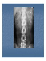 Bài giảng một số bất thường bẩm sinh bộ máy tiết niệu part 5 potx