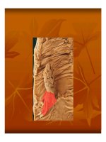 Giải phẫu bệnh - Bệnh học u part 5 docx