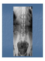 Bài giảng kỹ thuật thăm khám và hình ảnh của hệ tiết niệu part 3 ppt