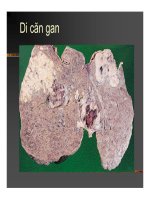 Giải phẫu bệnh - Ung thư part 10 docx