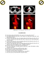 Giáo trình hướng dẫn phân tích khối ưu tuyến giáp thận với phương pháp ghi hình phóng xạ p4 ppt