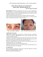 PHẪU THUẬT NỘI SOI CẮT TUYẾN HUNG TRONG ĐIỀU TRỊ NHƯỢC CƠ pps