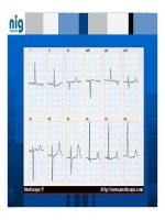 Bài giảng Tăng huyết áp part 5 ppt