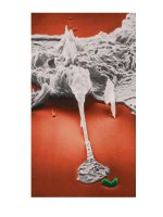 Bài giảng bệnh lý học thú y : Tế bào viêm part 3 pot