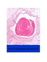 Bài giảng bệnh lý học thú y : Rối loạn tuần hoàn cục bộ part 7 pps