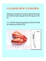 Đại cương về Mô và Phôi : PHÁT TRIỂN CỦA CÁ XƯƠNG part 2 pptx