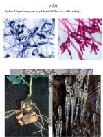 Các loài nấm và virut thường gặp ppt