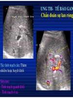 Chẩn doán hình ảnh : U Gan part 7 potx