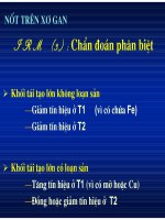 Chẩn doán hình ảnh : U Gan part 10 pot