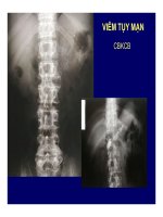 Viêm tụy cấp và mãn tính part 8 ppsx