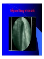 Thực hành x quang tim mạch part 9 pdf