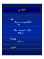 Giải phẫu thần kinh đối chiếu chẩn đoán Hình ảnh part 6 ppsx