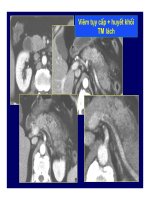 Viêm tụy cấp và mãn tính part 7 docx