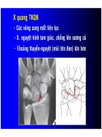 Chẩn đoán TRẬT KHỚP QUANH NGUYỆT part 3 ppsx