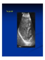 Chẩn doán hình ảnh : Gan - Mật part 10 potx