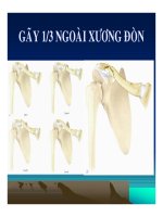 Các Gãy Xương Và Trật Khớp Vùng Đai Vai part 2 pot