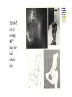 GÃY KHUNG CHẬU VÀ Ổ CỐI part 6 pps