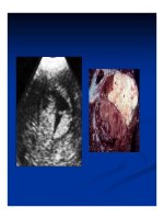 Chẩn doán hình ảnh : Gan - Mật part 6 pot