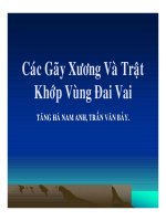 Các Gãy Xương Và Trật Khớp Vùng Đai Vai part 1 docx