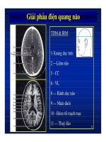 Giải phẫu thần kinh đối chiếu chẩn đoán Hình ảnh part 7 doc