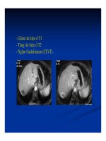 Chẩn doán hình ảnh : Gan - Mật part 4 ppt
