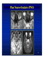 Bài giảng : Giải phẫu thần kinh đối chiếu chẩn đoán Hình ảnh part 4 doc